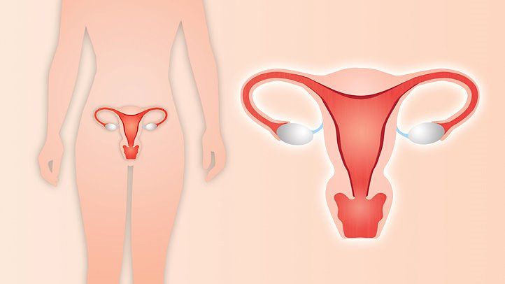 10 Things Your Doctor Won’t Tell You About Hysterectomy