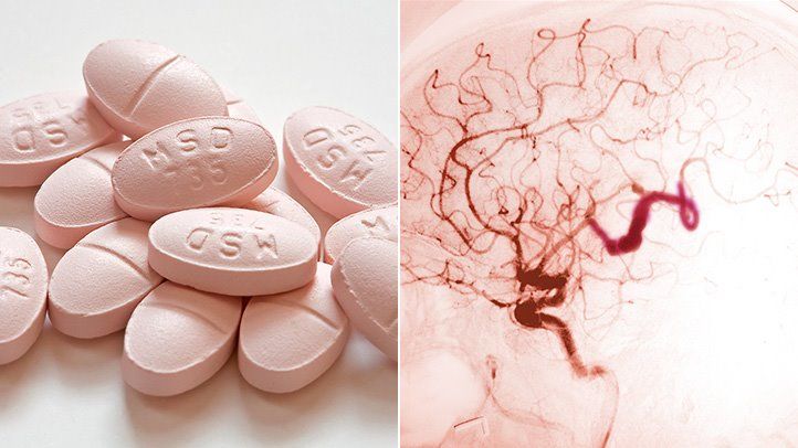 Can Statins Help Prevent Brain Aneurysms From Rupturing?