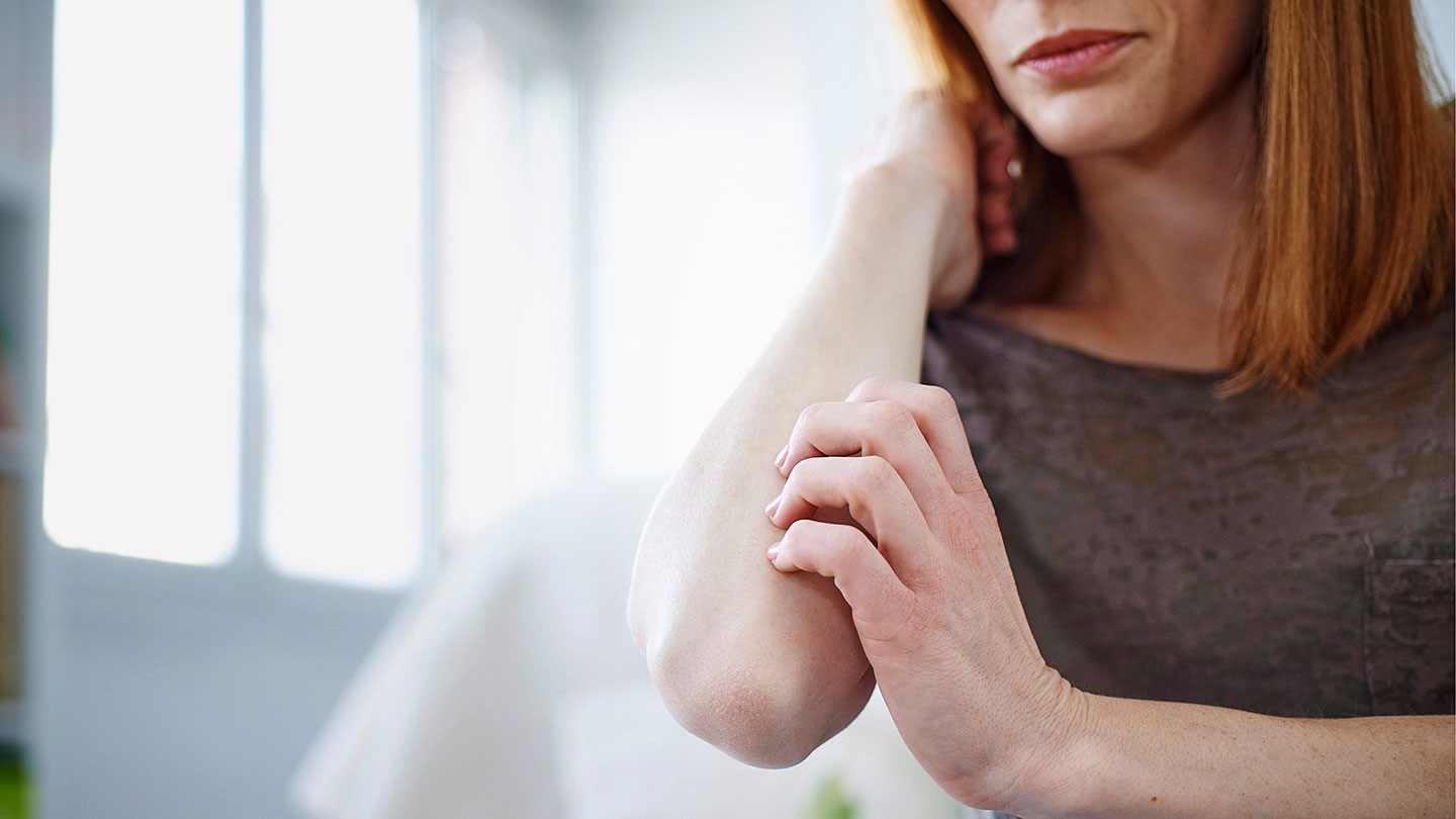 8 Ways to Relieve Your Psoriasis Itch
