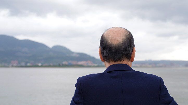 a man with balding hair